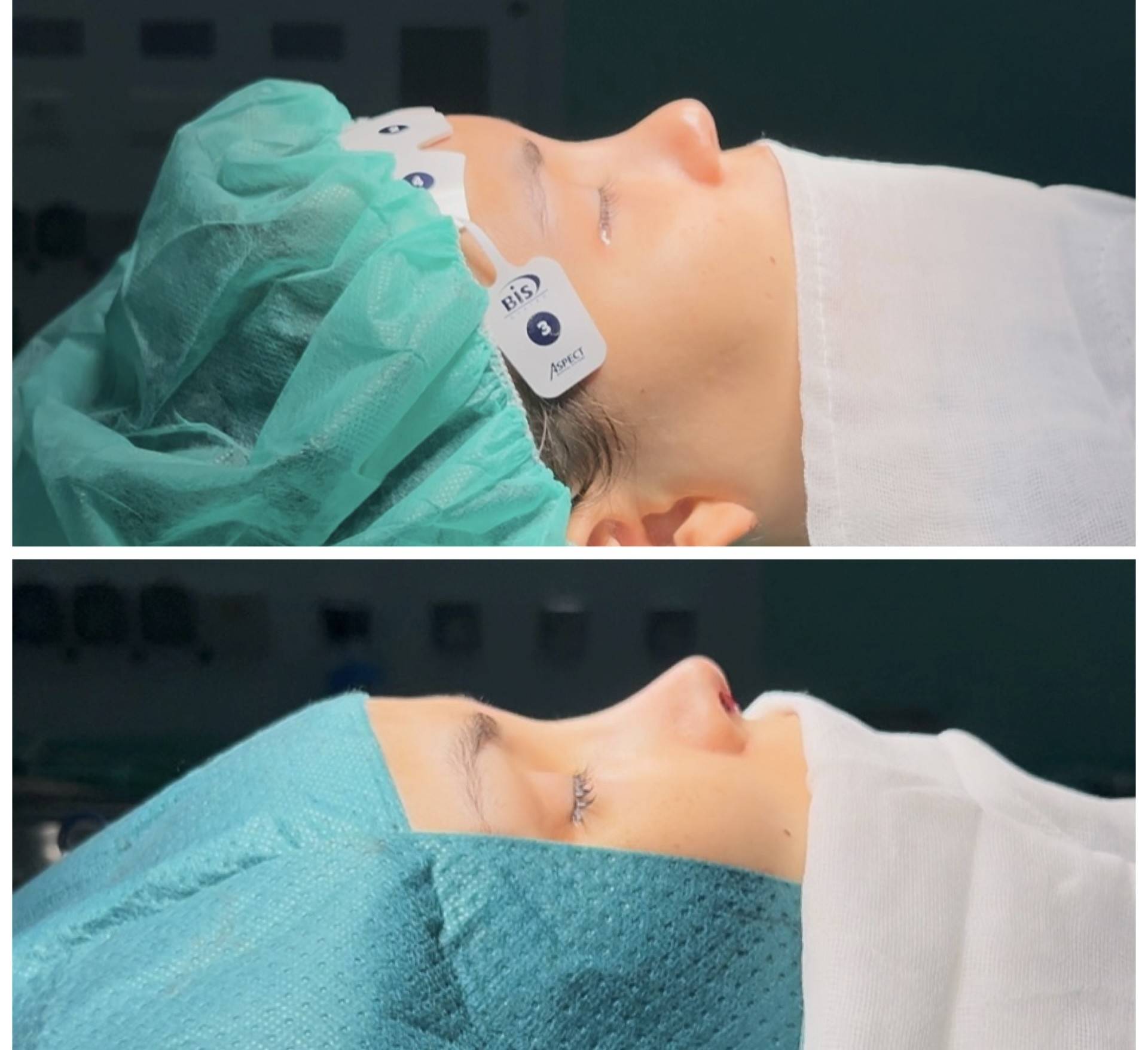 fotos antes y despues