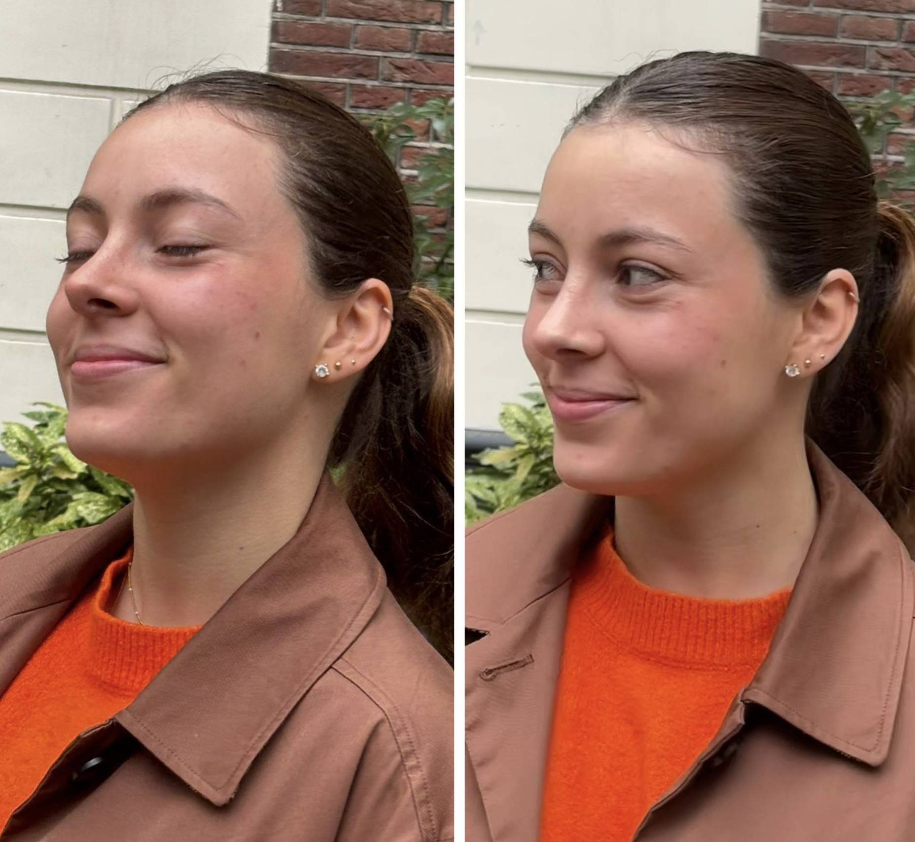 rino antes y depsues